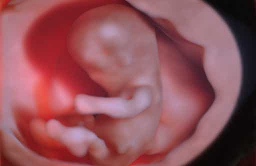 Embryo 12.SSW