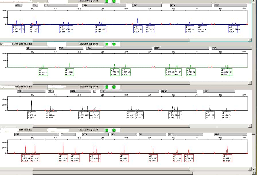Schnelltest PCR Polymerase-Kettenreaktion)