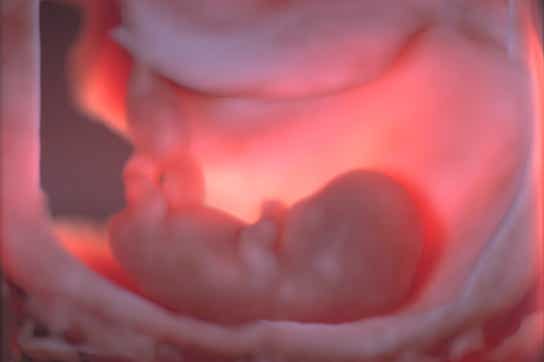 Embryo und Amnionhöhle 12. SSW 3D