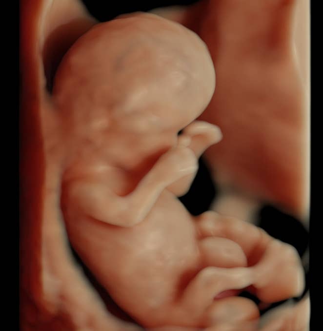 Embryo in der 12. SSW